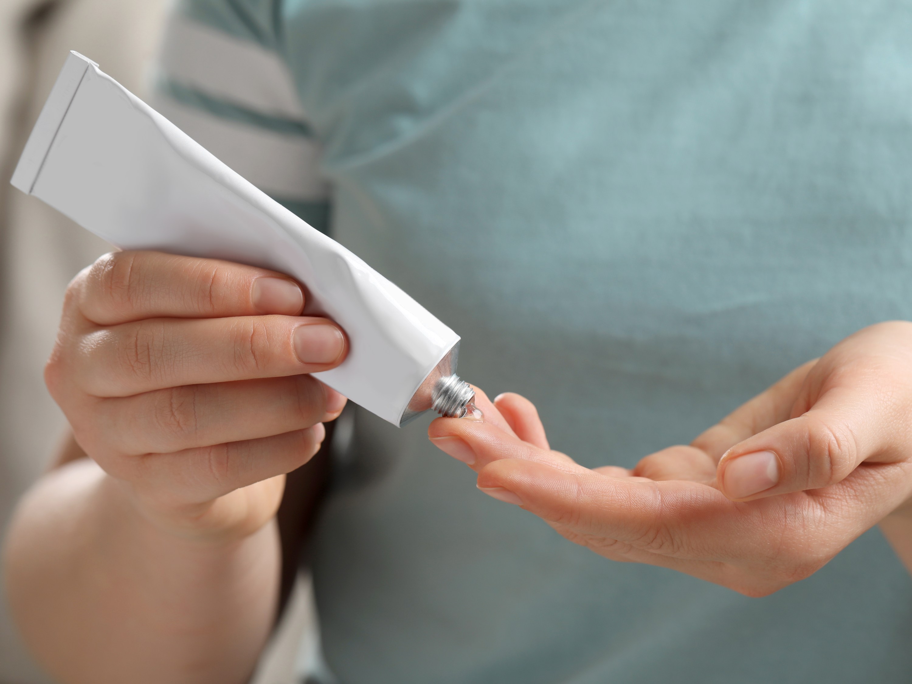 Woman applying ointment from tube onto her finger, closeup